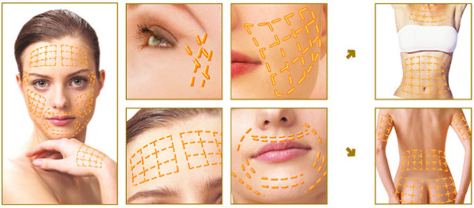 Facial reinforcement with gold threads
