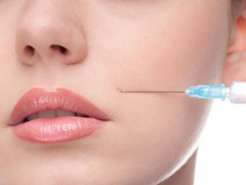 A Botox nem hatékony a nasolabial ráncok ellen