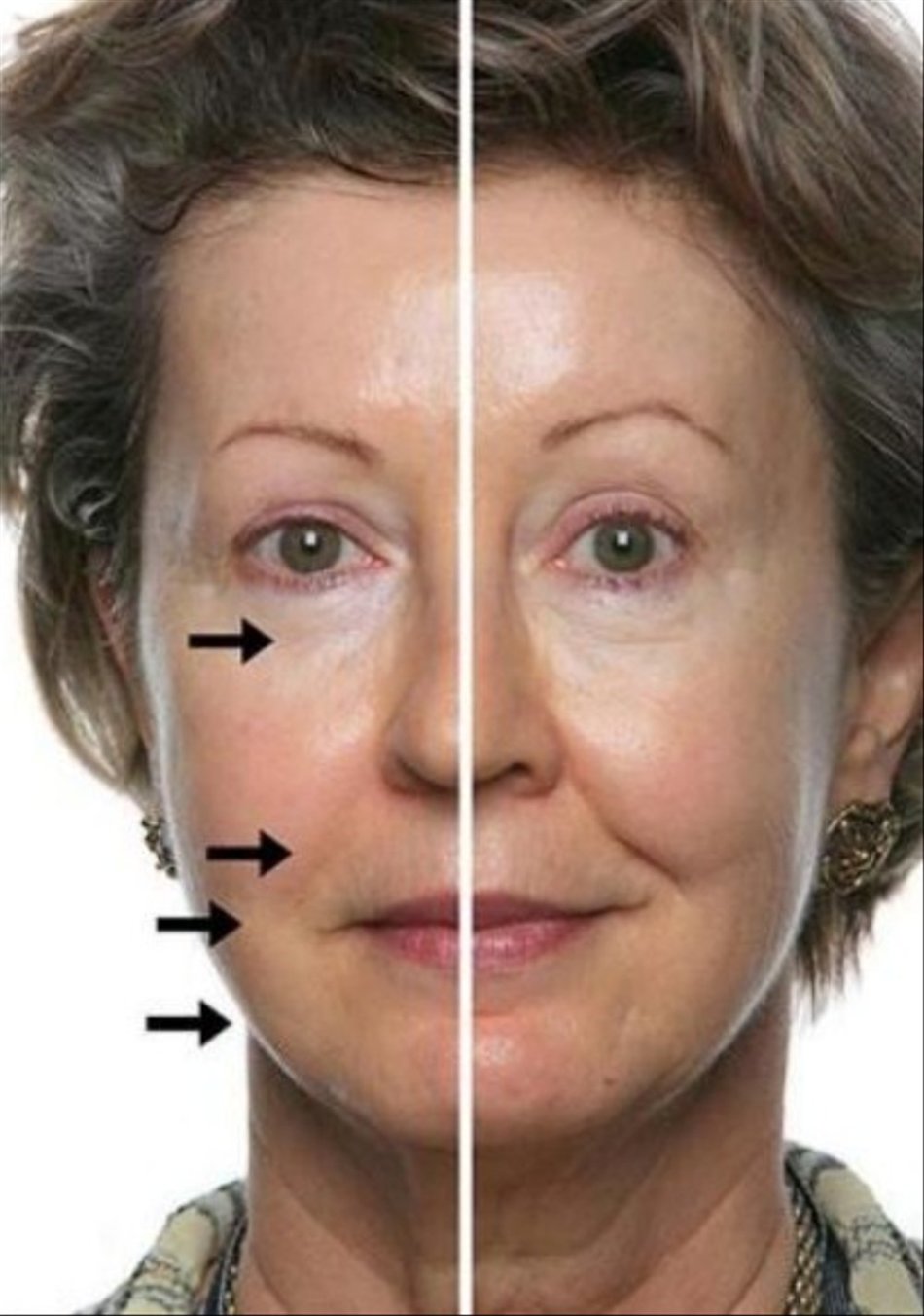 массаж лица фото до и после реальные