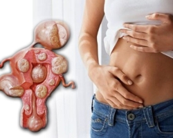 Fibroid uterus selama kehamilan: Apakah berbahaya, apa yang mengancam, apa konsekuensi bagi anak? Bisakah fibroid uterus membingungkan dengan kehamilan? Bisakah fibroid rahim menghancurkan, sakit atau menyelesaikan selama kehamilan?