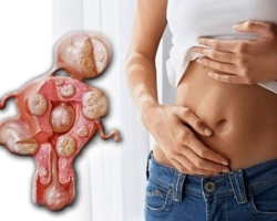 Fibroidy maternice počas tehotenstva: Je to nebezpečné, čo ohrozuje, aké sú dôsledky pre dieťa? Môžu maternicové fibroidy zamieňať s tehotenstvom? Môžu maternicové fibroidy rozdrviť, ochorieť alebo vyriešiť počas tehotenstva?