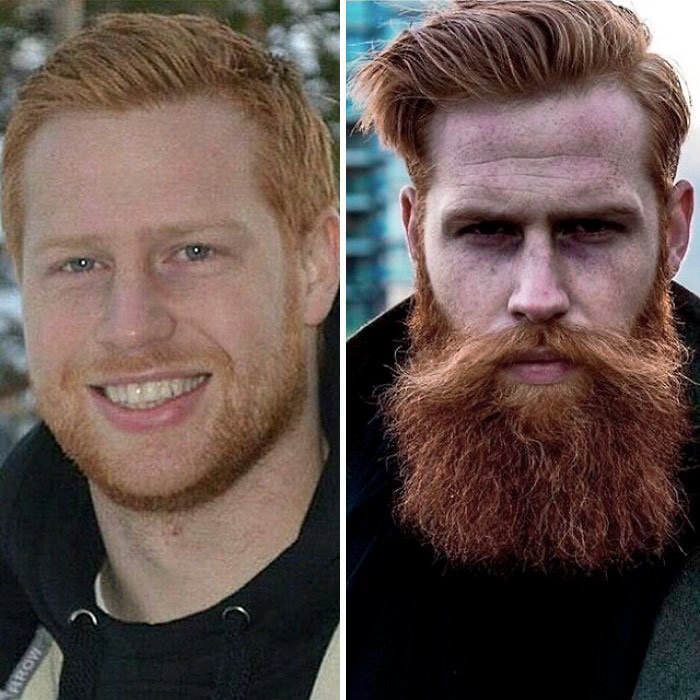 Как быстро отрастить бороду если тебе 13