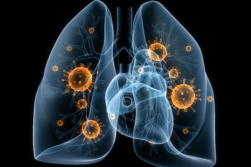 What is double -sided, focal, shared, Klebsiella, right -hand, left -handed, viral, croupous, aspiration, interstitial, basal, mycoplasmic, destructive, caseous, segmental, nososinophilic, eosinophilic, purulent, pneumocystic, streptococcal and pneumococcal, Klokamozna, hibstatična, gliva, gliva, gliva, gliva, gliva, gliva, gliva, gliva, gliva, gliva, gobe novorojenčke pljučnice in kako je nevarna?