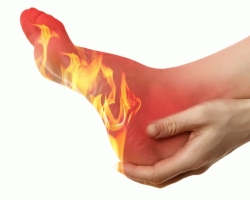 Why do legs burn with fire before bedtime, at night in women, men, pregnant and elderly people? At what disease do the feet, heels, fingers, caviar, knees burn? Burning in the legs: causes and treatment with drugs and folk remedies