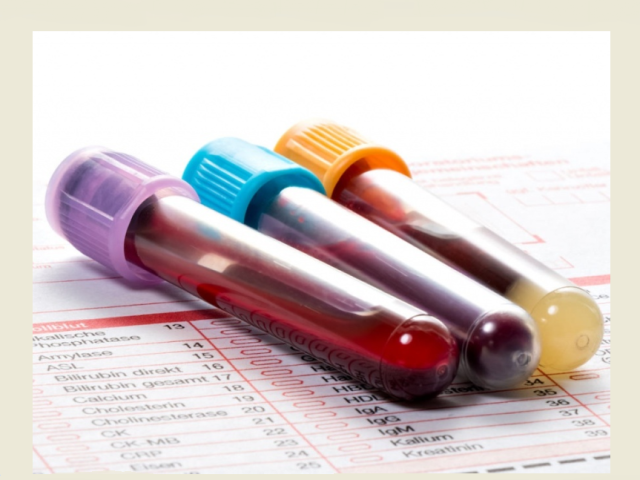Как прочитать анализы крови: норма, интерпретация результатов