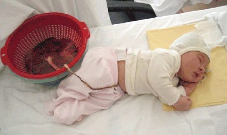 Дитина після народження лотоса