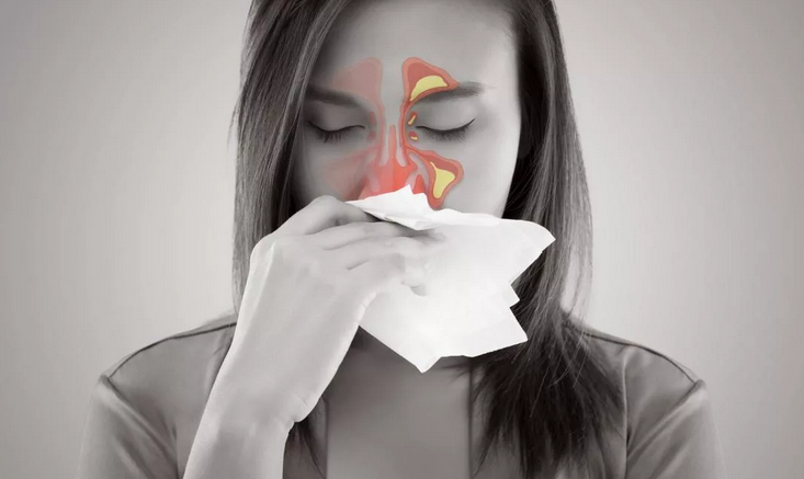 Nez: abcès du septum nasal