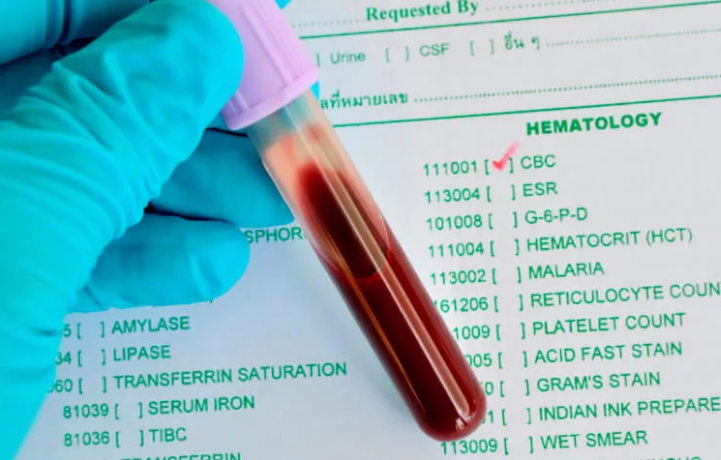 Characteristic of a blood test analysis of an adult