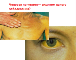 If a person has turned yellow, what can be the disease: reasons, what to do? Why does the skin, face, body, eyes of a person turn yellow: what does this mean?