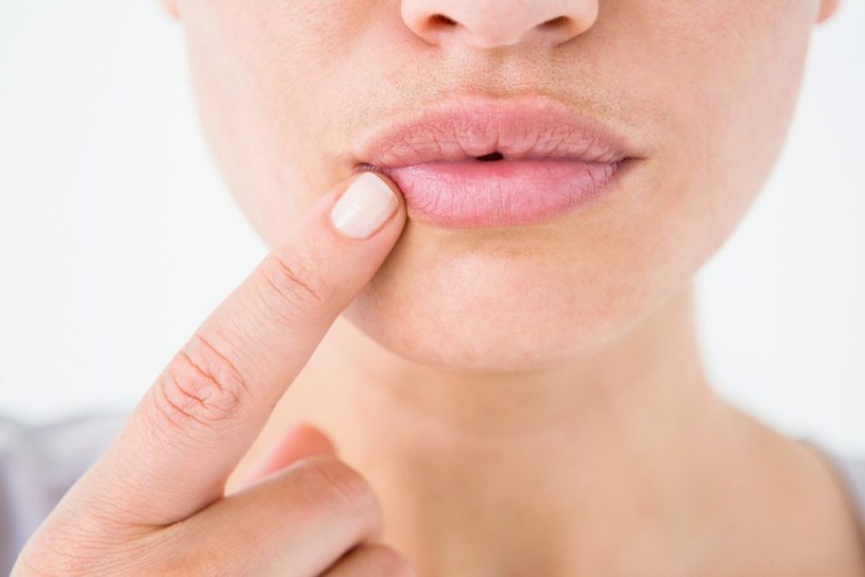 Как приподнять уголки губ