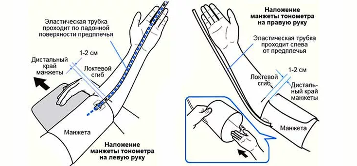 У скольких мужчин показатель для левой руки. Правильное положение манжеты при измерении давления. Ад на правой и левой руке норма. Измерение артериального давления на обеих руках. Разница артериального давления на руках норма.