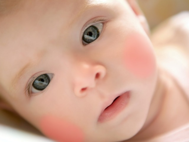 Foltok és kiütések a gyermek arcán és testén: piros, barna, fehér: okok és kezelés