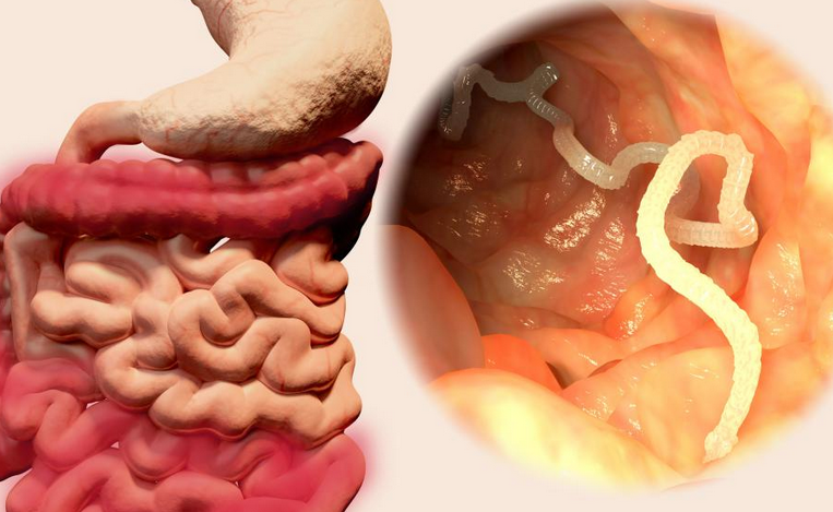 There may be heartburn due to parasites, worms