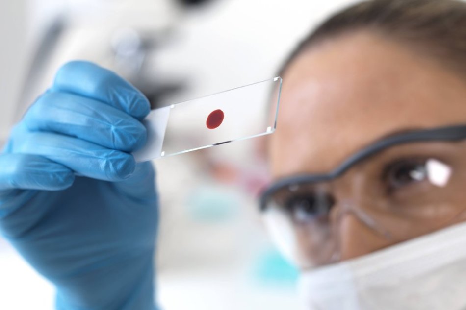 Pegawai laboratorium mempelajari darah di HCG