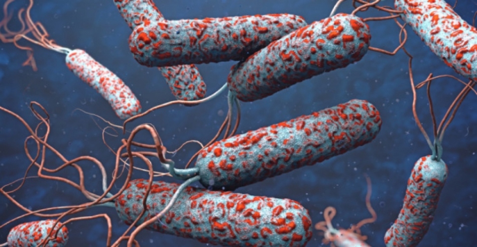 Cholera - intestinal infection causes cholera vibrio
