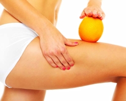 Warum erscheint Cellulite und wie man damit umgeht?