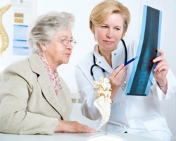 Osteoporosis in women after 50 years: signs, treatment and prevention, women's reviews