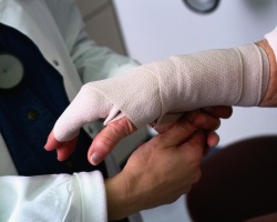 Σημάδια, σημάδια για να κόψετε ένα δάχτυλο με ένα ανώνυμο δεξί χέρι. Κόψτε το δάχτυλό σας