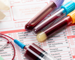 Splošni krvni test: sprejeti prazen želodec ali ne? Kako se pripraviti na krvno darovanje iz vene za splošno analizo?