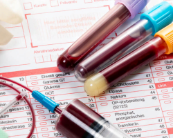 Allgemeiner Bluttest: Nehmen Sie einen leeren Magen auf oder nicht? Wie kann man sich für eine allgemeine Analyse auf eine Blutspende aus einer Ader vorbereiten?