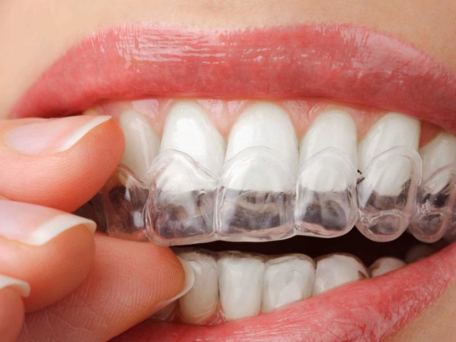 Comment renforcer les gencives si les dents sont stupéfiantes avec la maladie parodontale, la gingivite, la parodontite? La dent avant est stupéfiante, comment renforcer? La dent titube après le coup, comment renforcer?