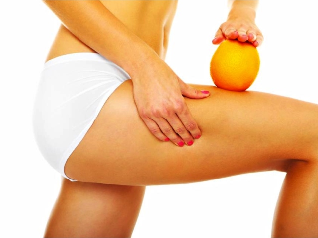 How to quickly get rid of cellulite? Effective anti -cellulite products, thermal procedures, exercises, diets