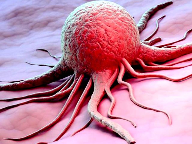Как определить рак по общему анализу крови, биохимическому, на онкомаркеры? Что может спровоцировать рак, какие внешние признаки рака? Что такое онкомаркеры?