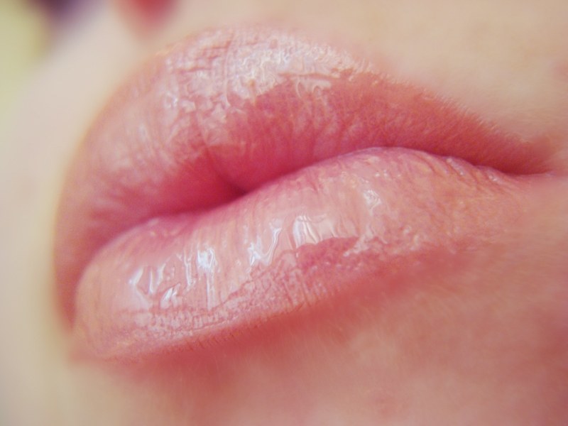 Обветренные губы в домашних условиях