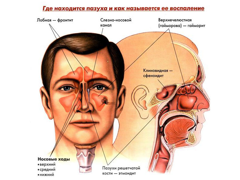 The location of the sinuses