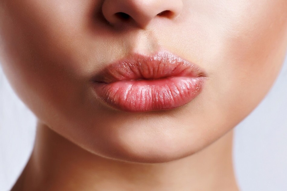 Heit terlokalisasi di bibir dan tidak mempengaruhi kulit di sekitarnya