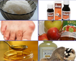 Gout: alternative methods of treatment in men and women