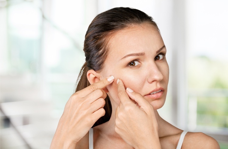 Anger - sin blocking beauty No. 7: independent squeezing of acne