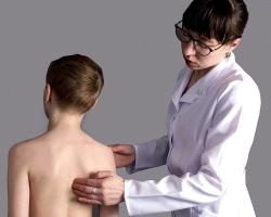 How to fix posture in a child? Causes of violation of posture in school and preschool children
