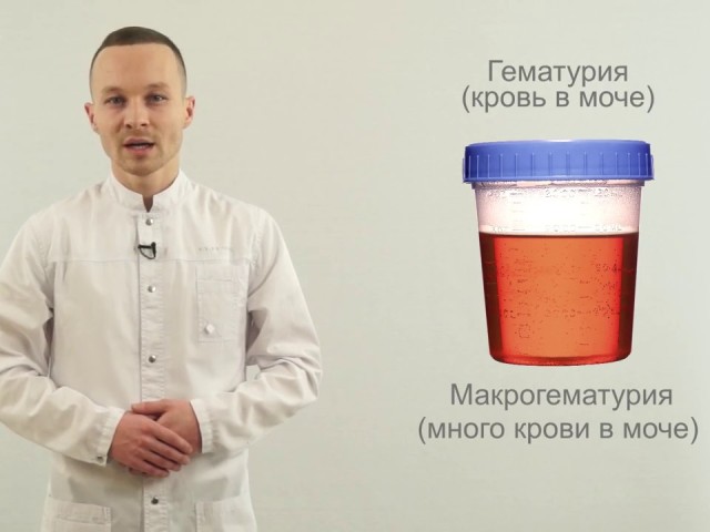 Blood in the urine in men, women, during pregnancy, in children: causes, treatment - what to do?