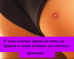 Why the pimple jumped on the priest, on the right and left buttocks, on the tailbone: a sign for girls, women and men. Interpretation of signs in size acne, by day of the week