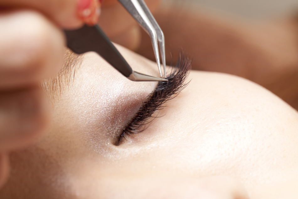 After eyelash extensions, eyelids may swell