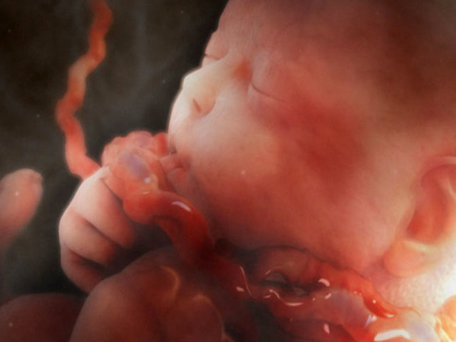 สายสะดือรอบคอของทารกในครรภ์: สาเหตุและผลที่ตามมา การคลอดบุตรด้วยสายสะดือ