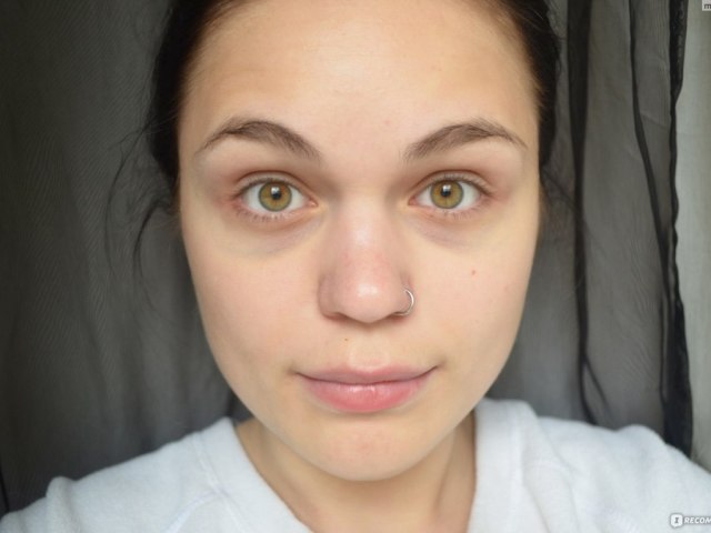 Recipes for effective masks from bruises under the eyes at home: how to remove?