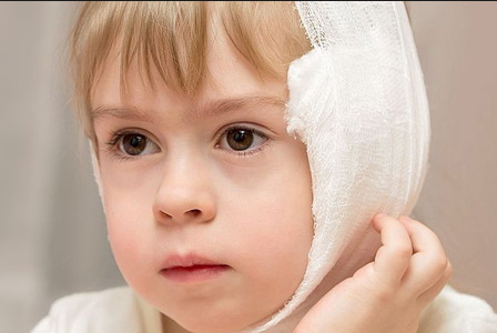 Компресс на ухо ребенку при отите делают только в том случае, когда болезнь протекает в катаральной форме и без температуры.