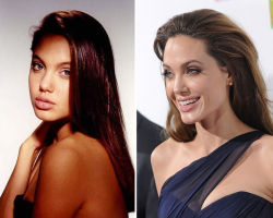 Stars with which plastic benefits: TOP-15, photo before and after