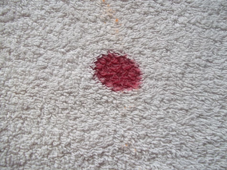 Как вывести застарелые пятна крови на ковре?