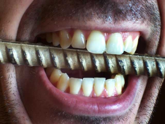 D des dents de gingembre dans un rêve. 5 principales causes de dents grinçant chez les adultes et les enfants