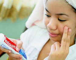 Does the toothpaste help with acne on the face? How to remove, dry acne and redness using toothpaste: tips, contraindications, effect, reviews. Soda and paste from acne - a mask recipe: how to apply properly, how much to keep?