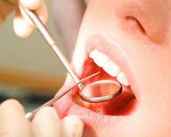 Oteklega obraza po ekstrakciji zob, kaj storiti? Ali obraz nabrekne po odstranitvi modrostnega zoba? Kako izpeljati in kaj piti, ko se zob odstrani iz edema?