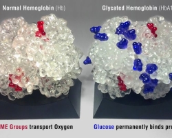 Lo que muestra un análisis para el descifrado de hemoglobina glucosada. ¿Cómo donar sangre a la hemoglobina glucosed?