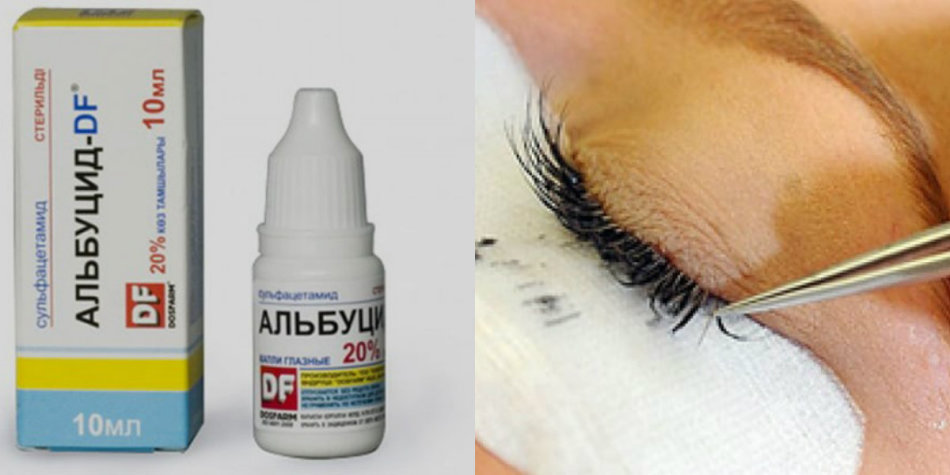 As a means of removing extended eyelashes, you can use albucid drops.