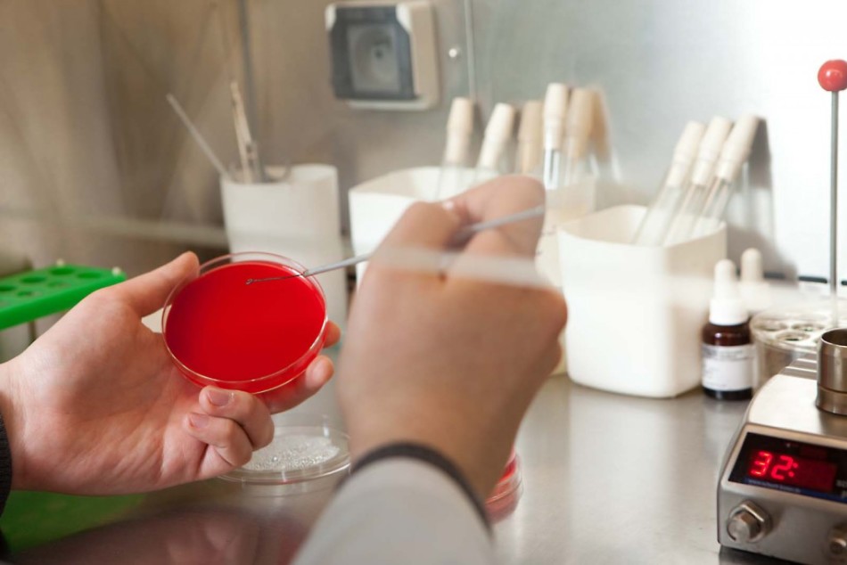 Bagaimana antibiotik mempengaruhi tes darah dan urin?