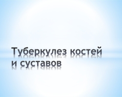 Tuberkuloza kostiju i zglobova: lokalizacija i oblici bolesti, načini infekcije i simptoma, dijagnostička tehnika, liječenje kostiju tuberkuloze i zglobova
