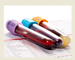 How to read blood tests: norm, interpretation of results