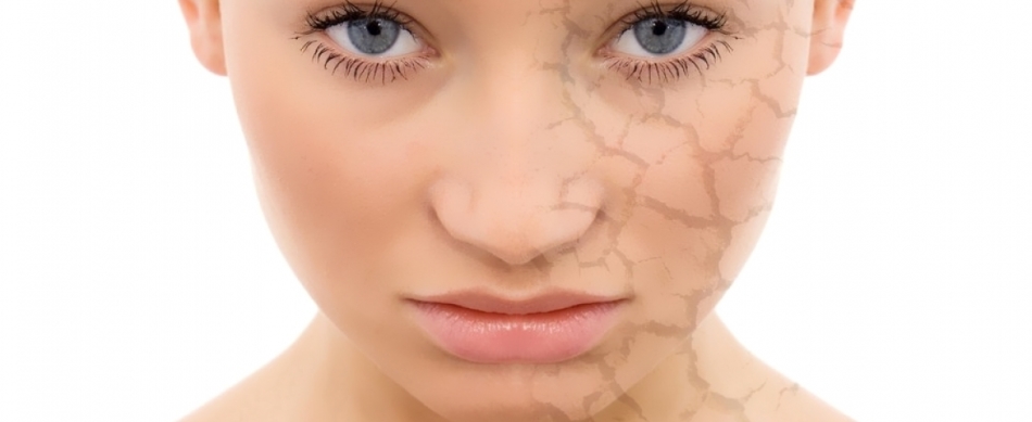 Why do pigment spots appear?